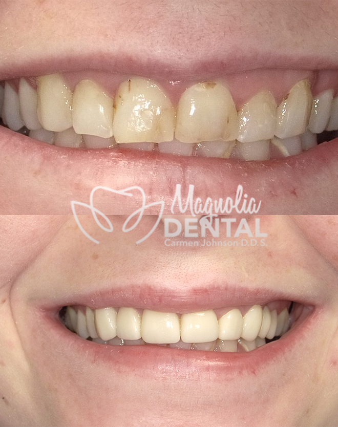 Magnolia Dental | Orthodontics, Cosmetic Dentistry and Preventative Program