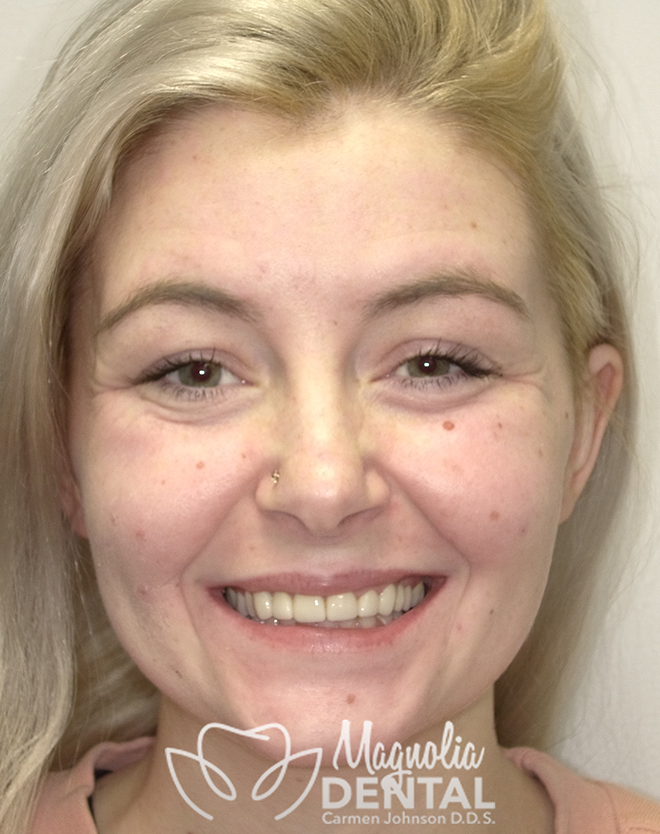 Magnolia Dental | Cosmetic Dentistry, ClearCorrect reg and Night Guards