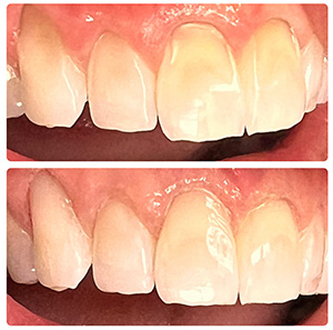 Magnolia Dental | Digital Radiography, Dentures and Cosmetic Dentistry