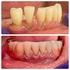 Magnolia Dental | Extractions, Emergency Treatment and Oral Exams