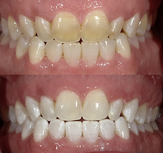 Magnolia Dental | Oral Exams, Digital Impressions and Root Canals