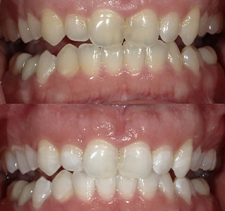 Magnolia Dental | Night Guards, Snoring Appliances and SureSmile reg