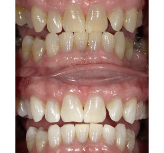 Magnolia Dental | Cosmetic Dentistry, Preventative Program and SureSmile reg