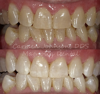 Magnolia Dental | Pediatric Dentistry, Cosmetic Dentistry and Crowns  amp  Caps