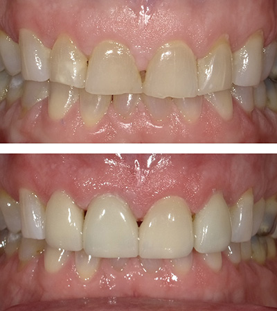 Magnolia Dental | Preventative Program, Orthodontics and Dentures